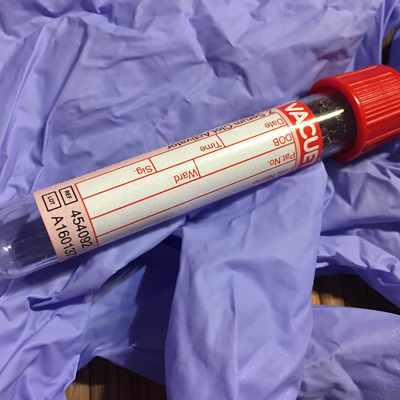 Market research of the market of blood collection systems in India